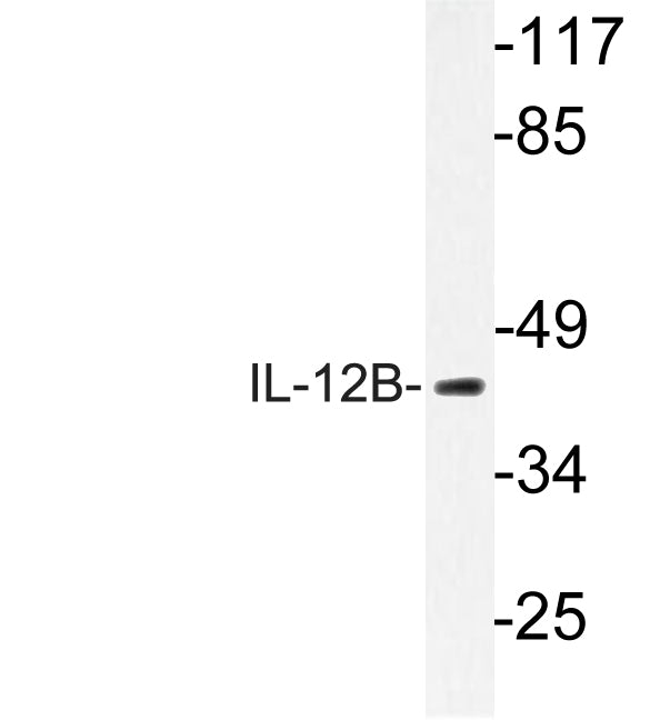 IL-12B Rabbit Polyclonal Antibody