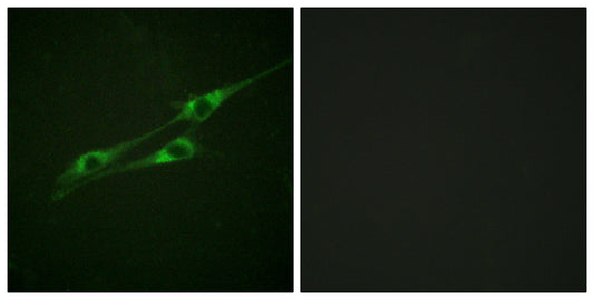 IL-13Rα1 Rabbit Polyclonal Antibody