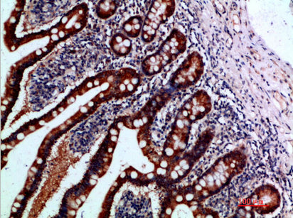 IL-1F7 Rabbit Polyclonal Antibody