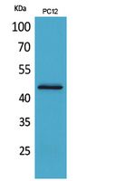 IL-1RII Rabbit Polyclonal Antibody