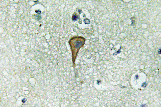 IL-20Rα Rabbit Polyclonal Antibody