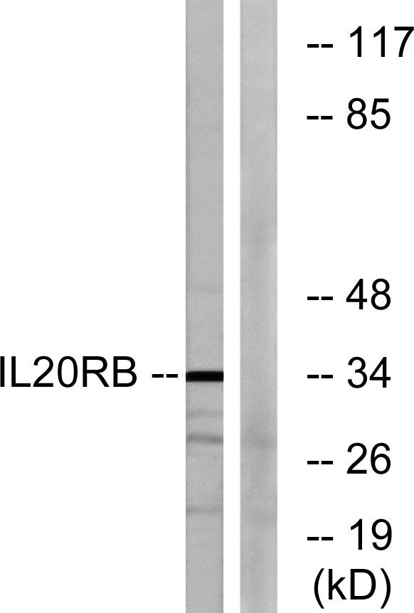 IL-20Rβ Rabbit Polyclonal Antibody