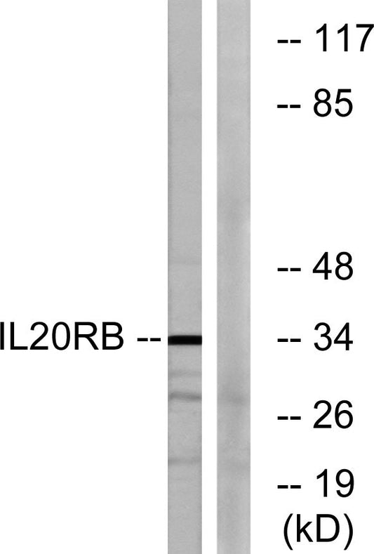 IL-20Rβ Rabbit Polyclonal Antibody