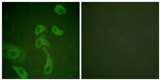 IL-2Rβ Rabbit Polyclonal Antibody