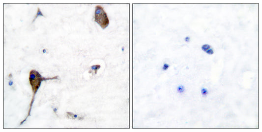 IL-3Rβ Rabbit Polyclonal Antibody