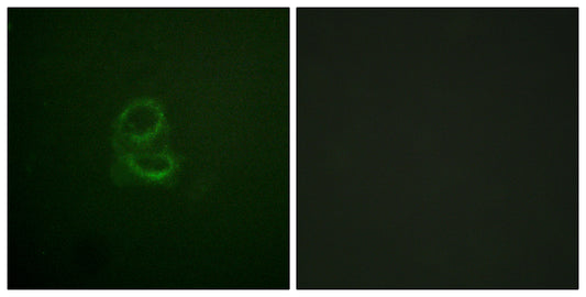 IL-4Rα Rabbit Polyclonal Antibody