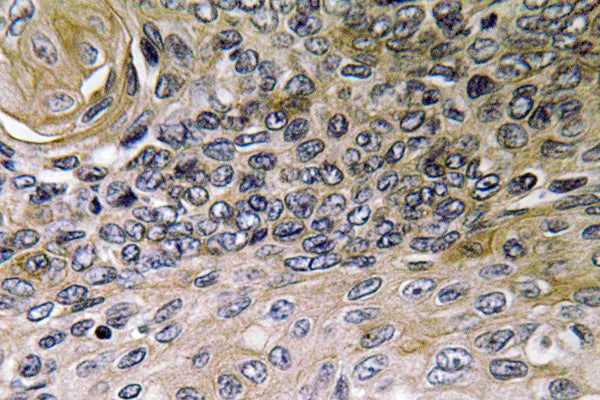 IL-8 Rabbit Polyclonal Antibody
