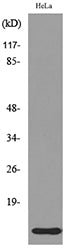 IL-8 Rabbit Polyclonal Antibody