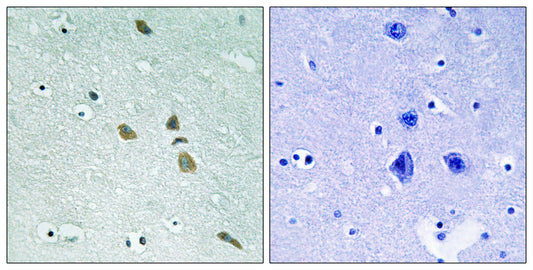 ILK Rabbit Polyclonal Antibody