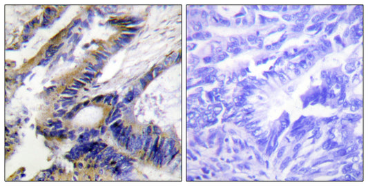 ILKAP Rabbit Polyclonal Antibody
