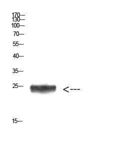 Imp3 Rabbit Polyclonal Antibody