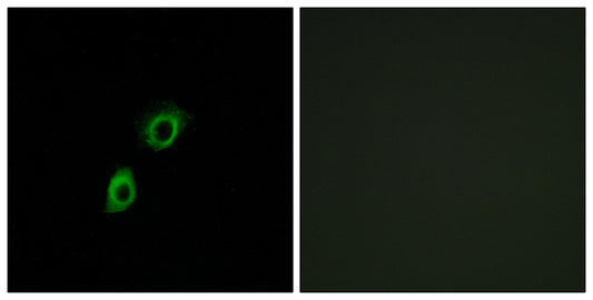 INSL4 Rabbit Polyclonal Antibody