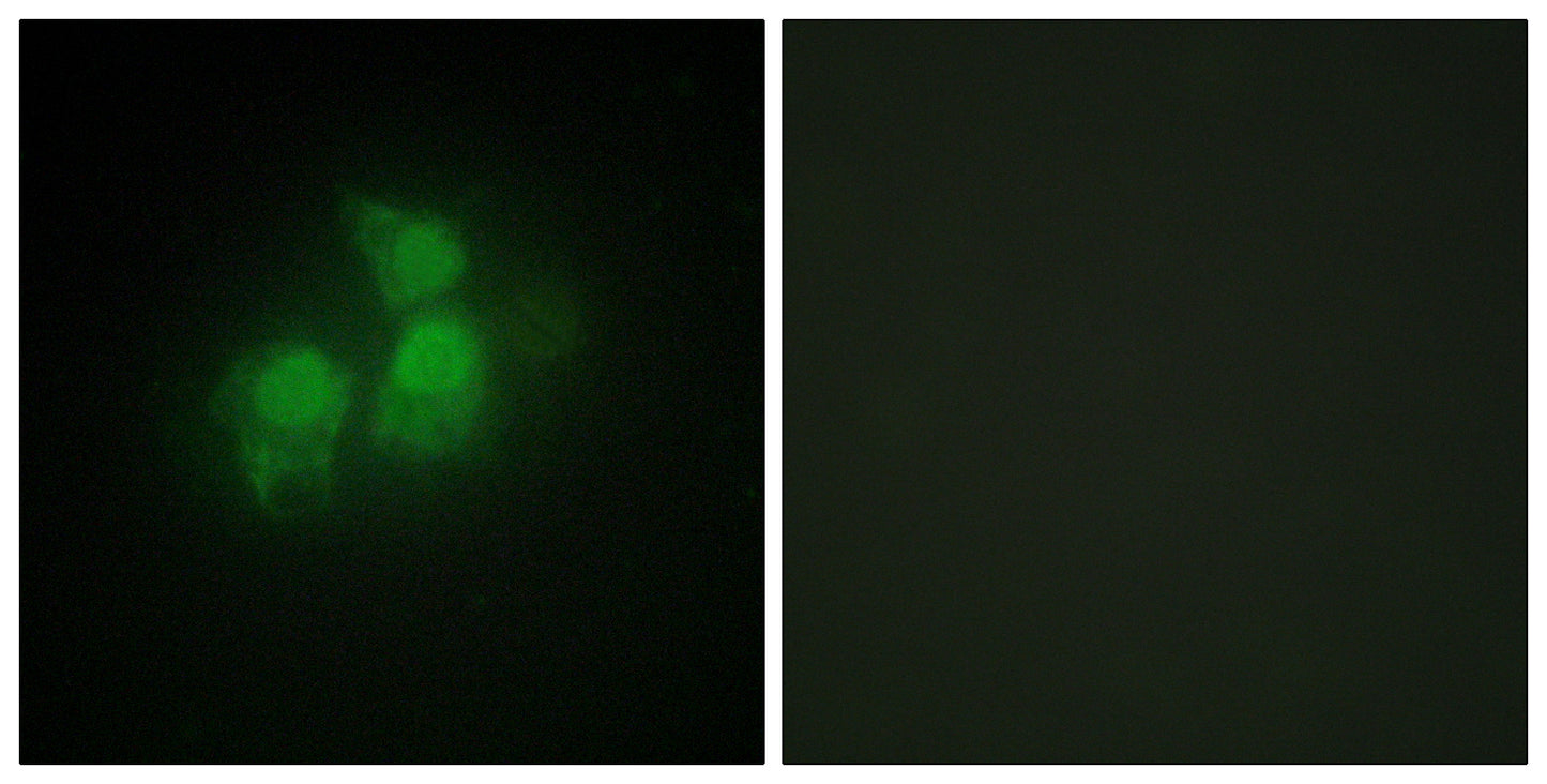 InsP5 2-kinase Rabbit Polyclonal Antibody