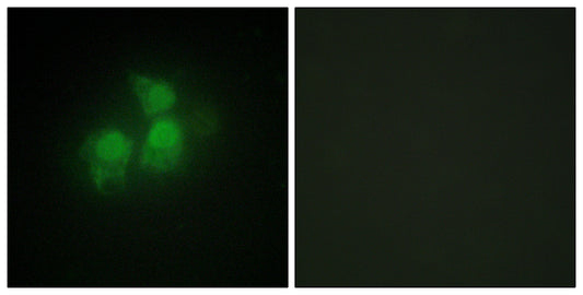 InsP5 2-kinase Rabbit Polyclonal Antibody