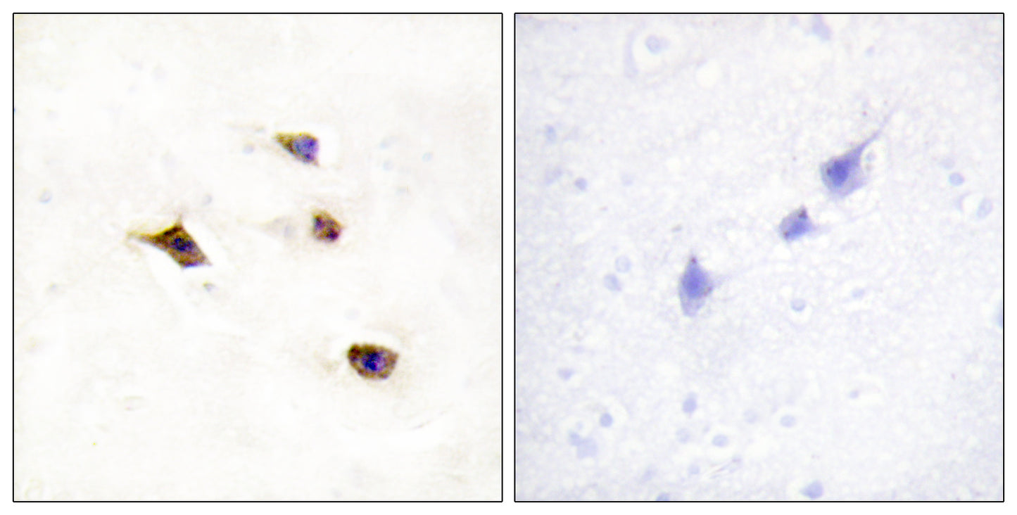 InsP6 Kinase 3 Rabbit Polyclonal Antibody