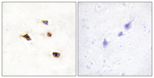 InsP6 Kinase 3 Rabbit Polyclonal Antibody