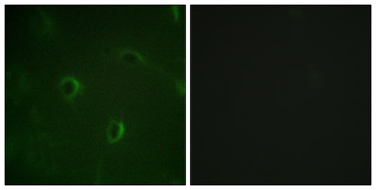 Insulin R Rabbit Polyclonal Antibody