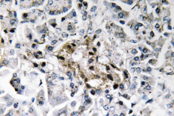 Insulin Rabbit Polyclonal Antibody