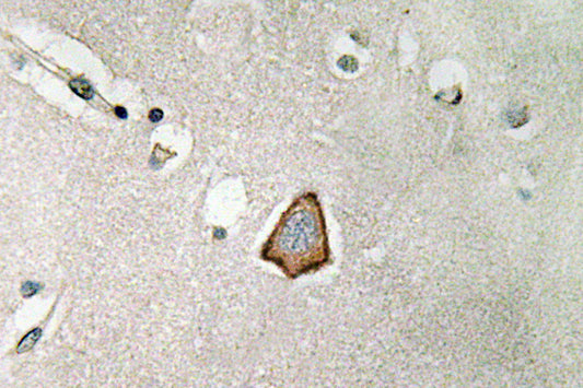 Integrin αV Rabbit Polyclonal Antibody