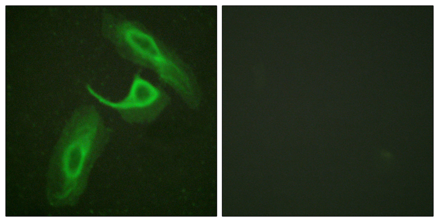 Integrin β2 Rabbit Polyclonal Antibody