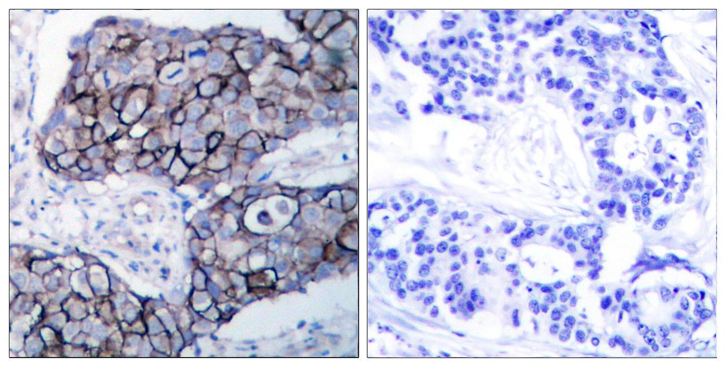 Integrin β3 Rabbit Polyclonal Antibody
