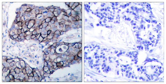 Integrin β3 Rabbit Polyclonal Antibody
