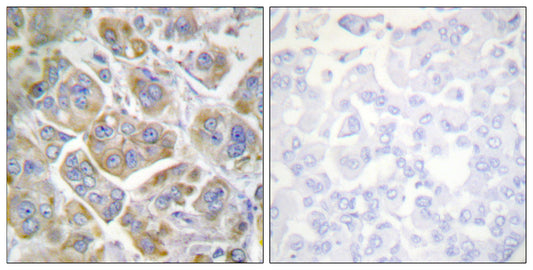 Integrin β4 Rabbit Polyclonal Antibody