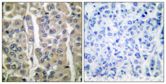 Involucrin Rabbit Polyclonal Antibody