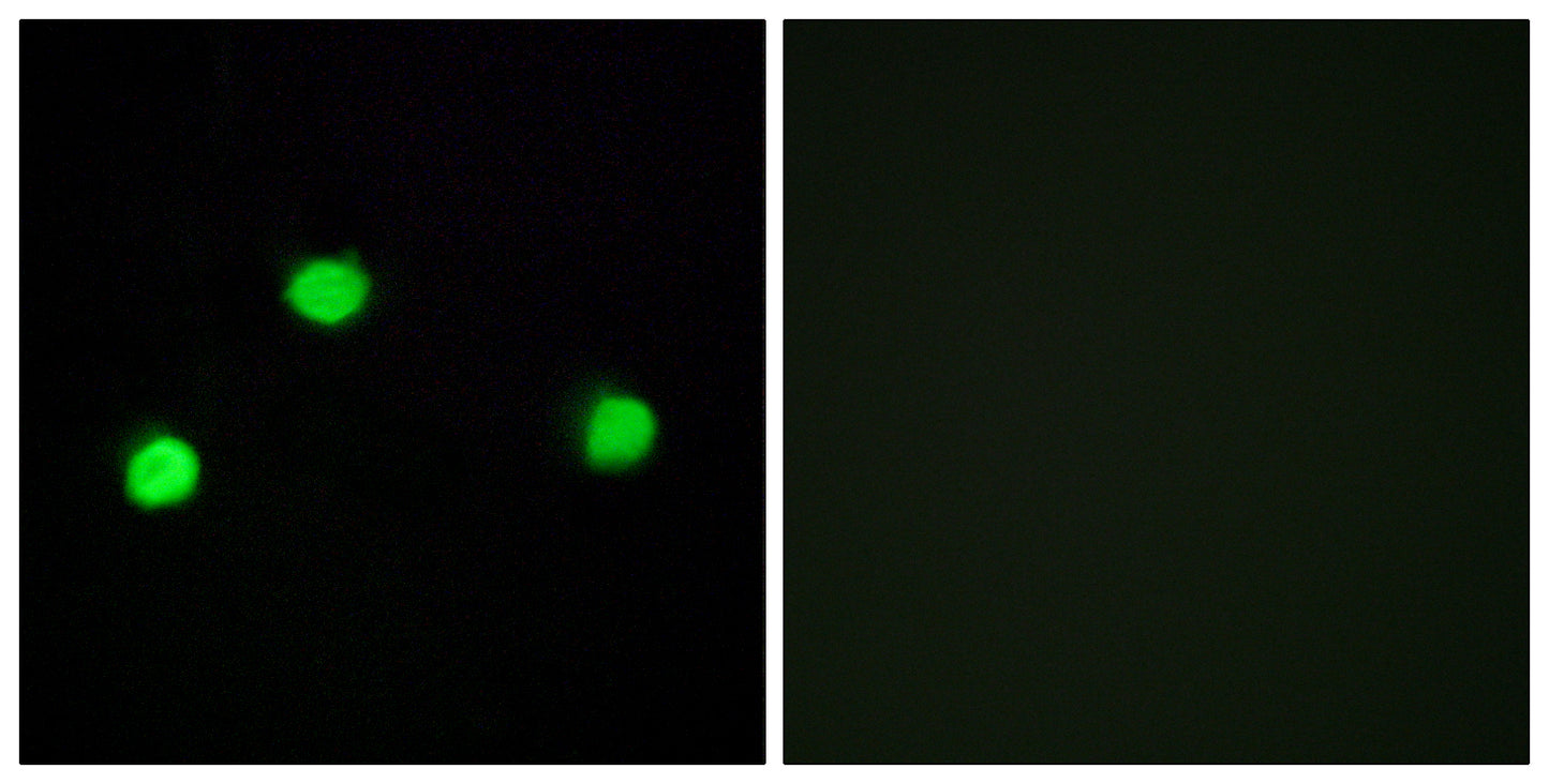 IP6K2 Rabbit Polyclonal Antibody