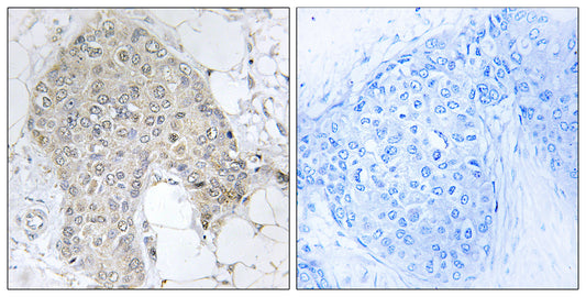 IPP-2 Rabbit Polyclonal Antibody