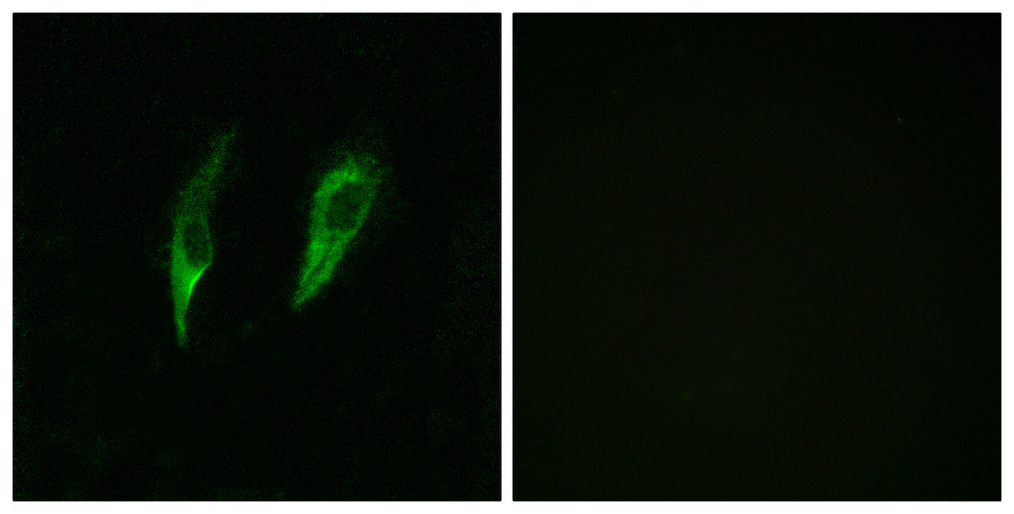 IRAK-M Rabbit Polyclonal Antibody