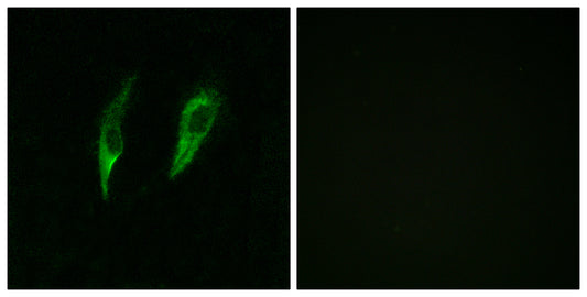 IRAK-M Rabbit Polyclonal Antibody