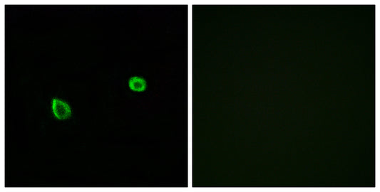 IRE1α/β Rabbit Polyclonal Antibody