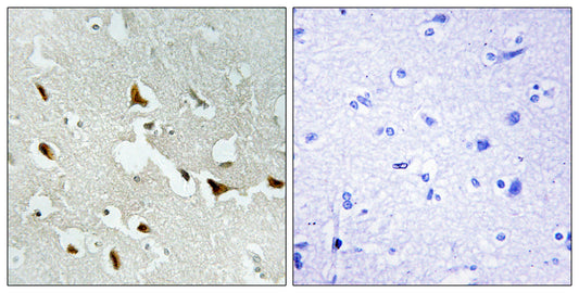 IRS-1 Rabbit Polyclonal Antibody