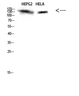 IRS2 Rabbit Polyclonal Antibody