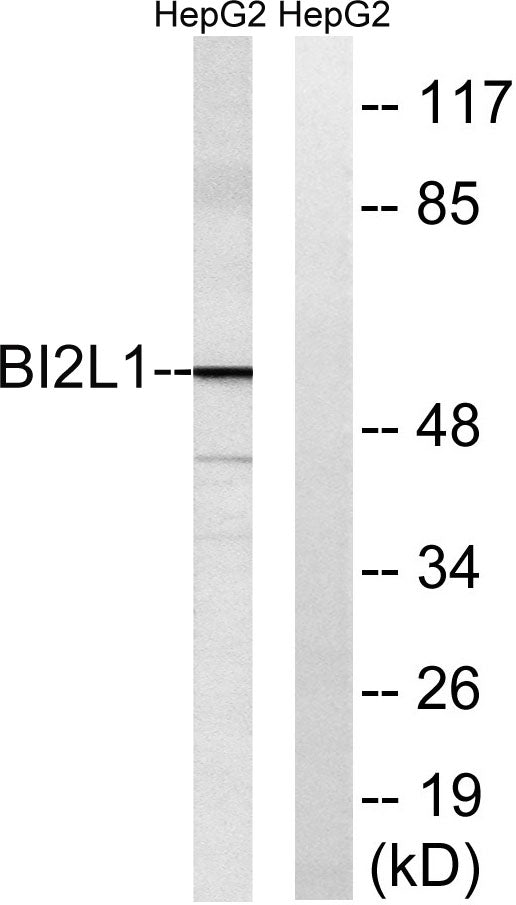 IRTKS Rabbit Polyclonal Antibody