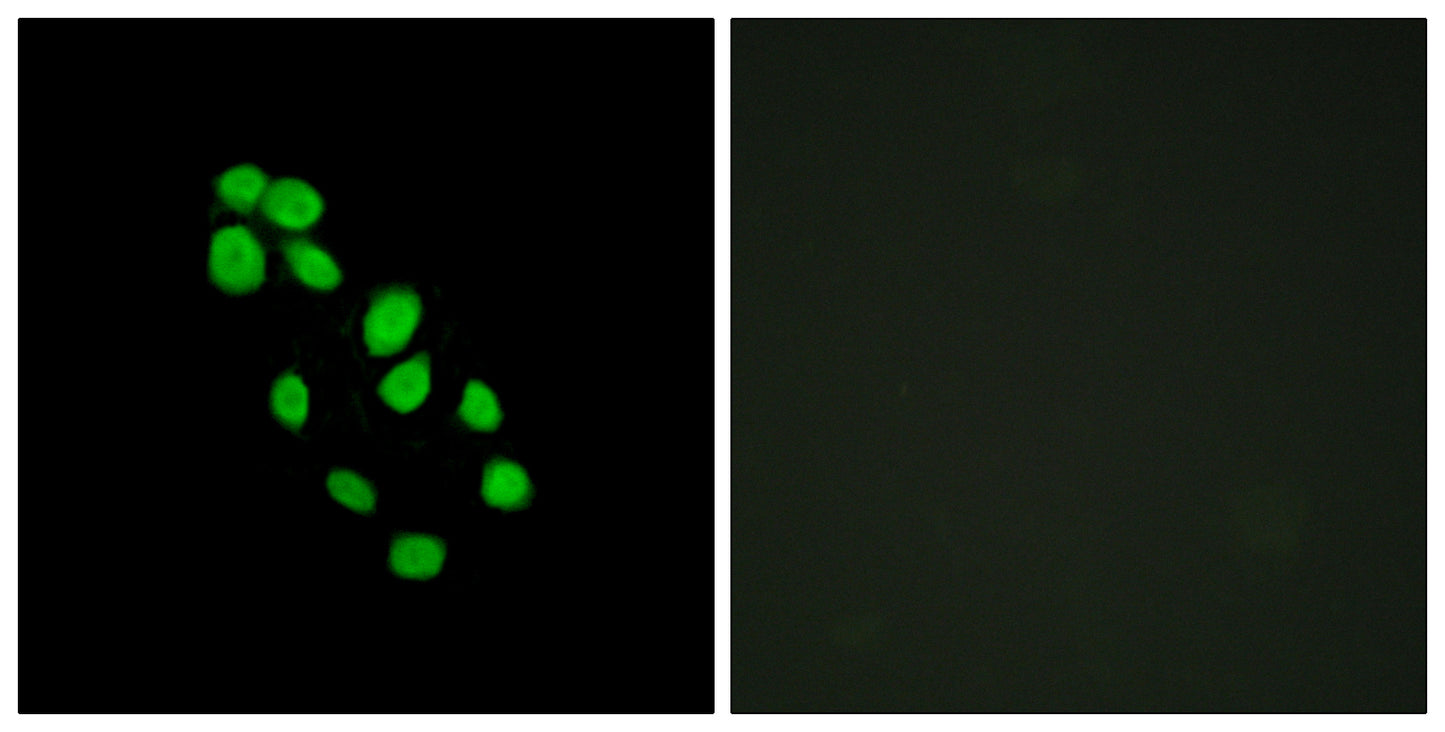 IRX2 Rabbit Polyclonal Antibody