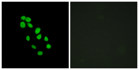 IRX2 Rabbit Polyclonal Antibody