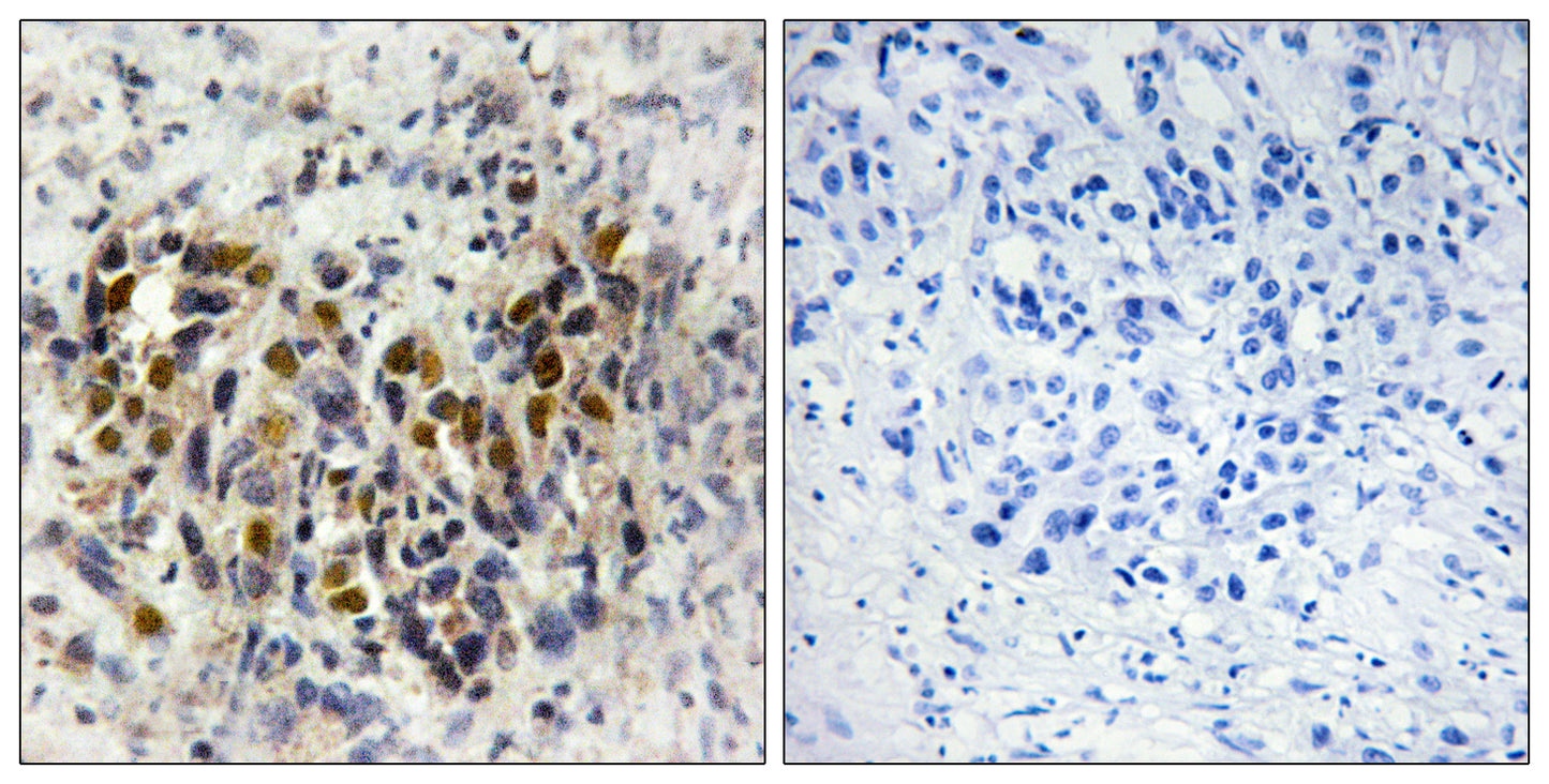 IRX3 Rabbit Polyclonal Antibody