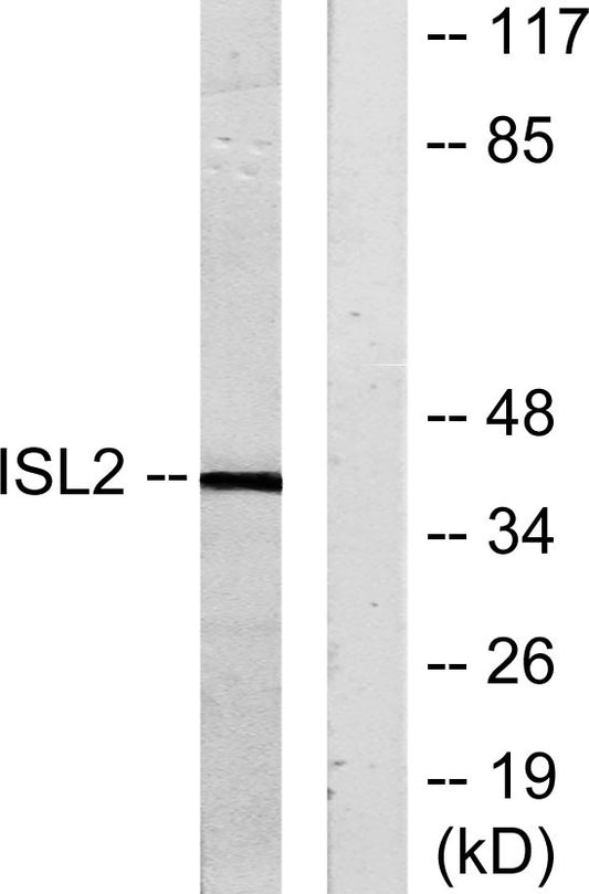 Islet-2 Rabbit Polyclonal Antibody