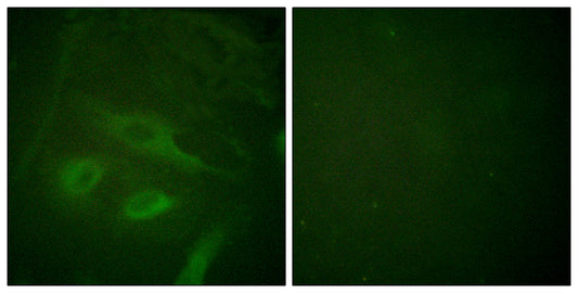 IκB-ε Rabbit Polyclonal Antibody