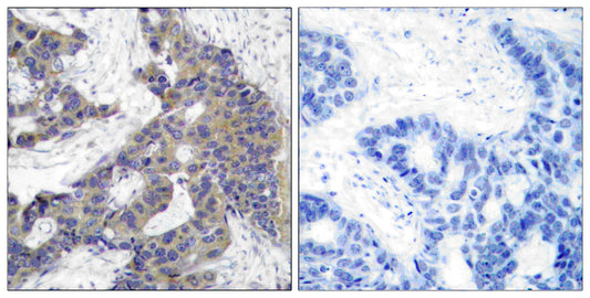 JAK2 Rabbit Polyclonal Antibody