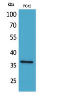 JAM-A Rabbit Polyclonal Antibody