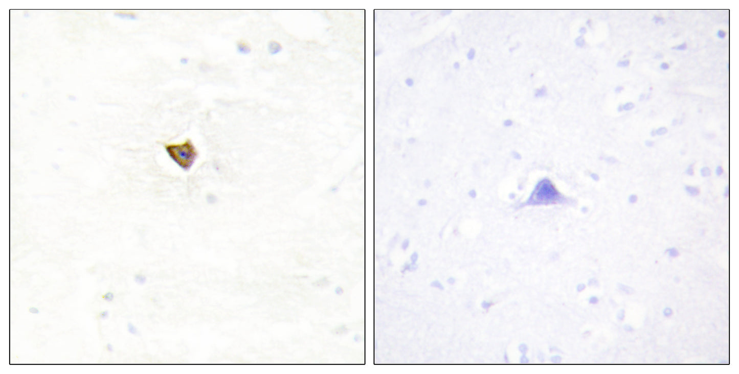 Jamip2 Rabbit Polyclonal Antibody