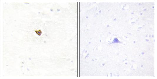Jamip2 Rabbit Polyclonal Antibody