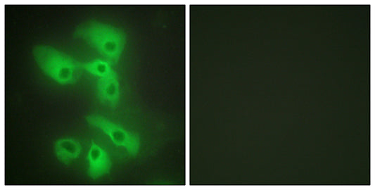JIP-2 Rabbit Polyclonal Antibody