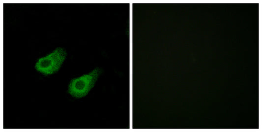 JIP-3 Rabbit Polyclonal Antibody