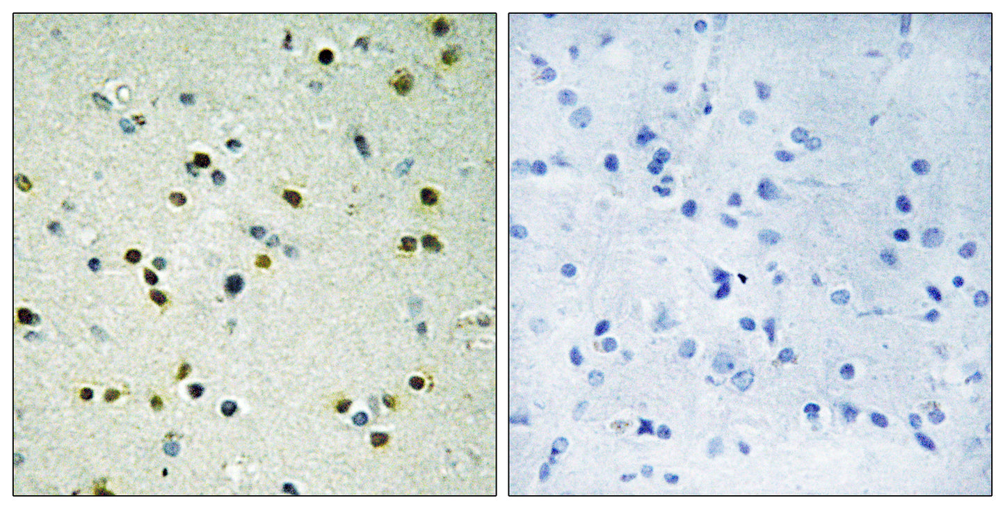 JMJD2B Rabbit Polyclonal Antibody