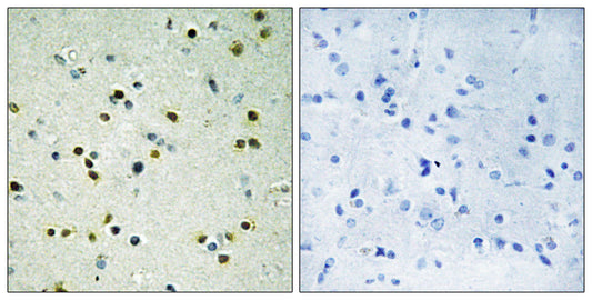 JMJD2B Rabbit Polyclonal Antibody