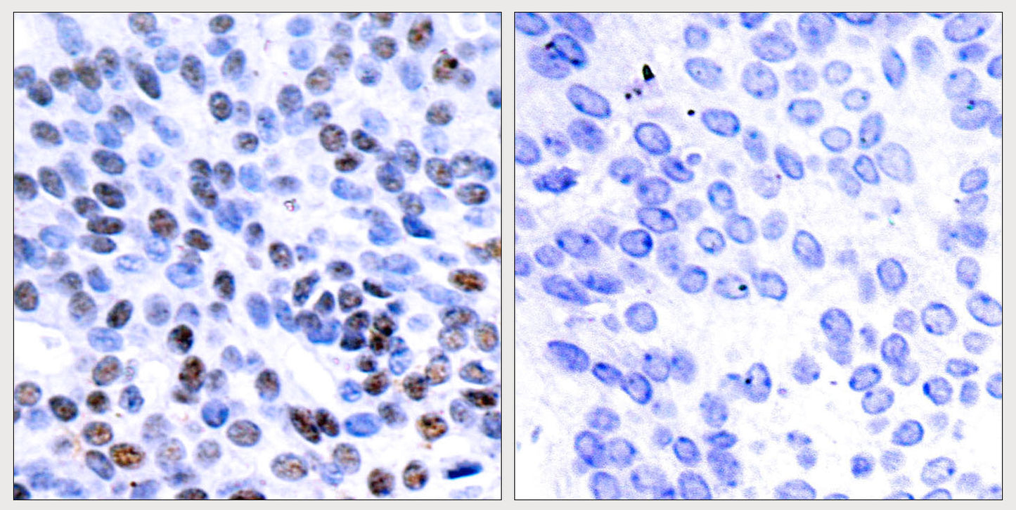 Jun B Rabbit Polyclonal Antibody